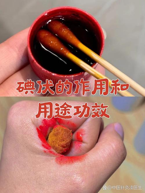 碘伏 家庭常备消毒剂的正确认知与使用指南